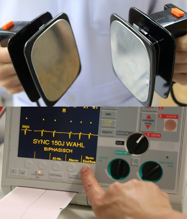 Bild: Elektrische Kardioversion